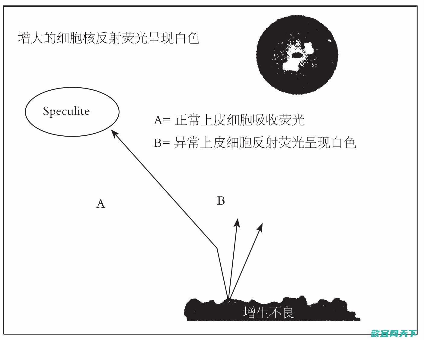 妇科检查上皮细胞到底是怎么回事呢